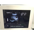 ultrasound machine price and ultrasound machine for pregnancy